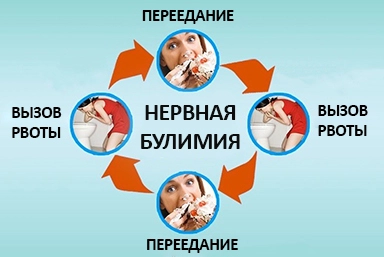 Лечение булимии в городе Урай